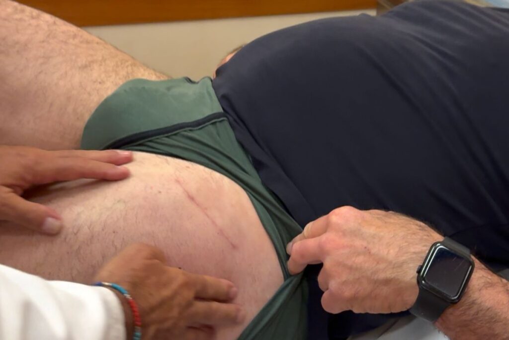 accesso bikini - Dr Riccardo Giacomi chirurgia d'anca via anteriore